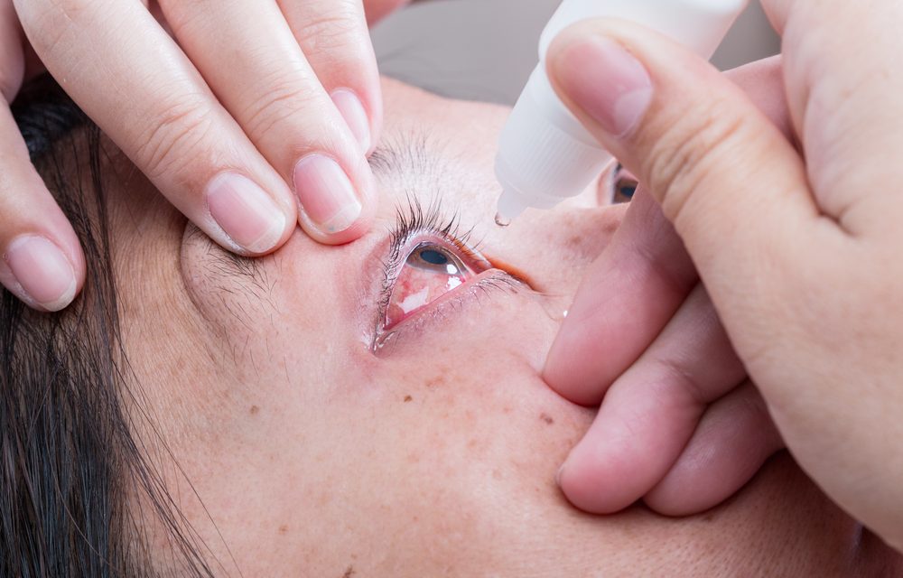 Qué es el glaucoma, consejos para prevenirlo