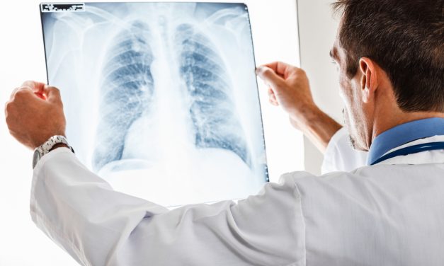 La necesidad de conocer la Fibrosis Pulmonar Idiopática