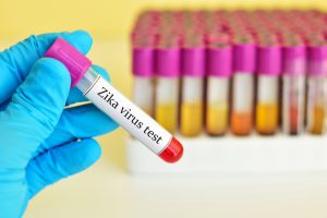 shutterstock 363993464 300x200 - 10 consejos para prevenir el contagio del virus Zika