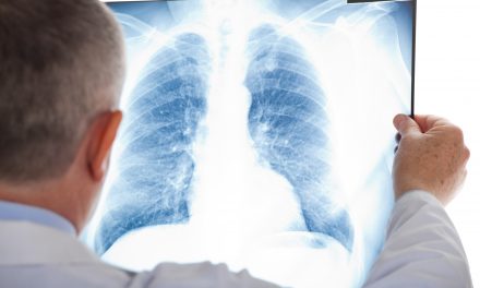 La Fundación Ricky Rubio y Novartis se unen en la prevención y concienciación social del cáncer de pulmón