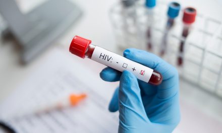 Europa da opinión positiva para el primer régimen de acción prolongada en el tratamiento del VIH