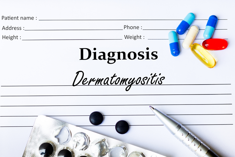 Dermatomiositis Juvenil