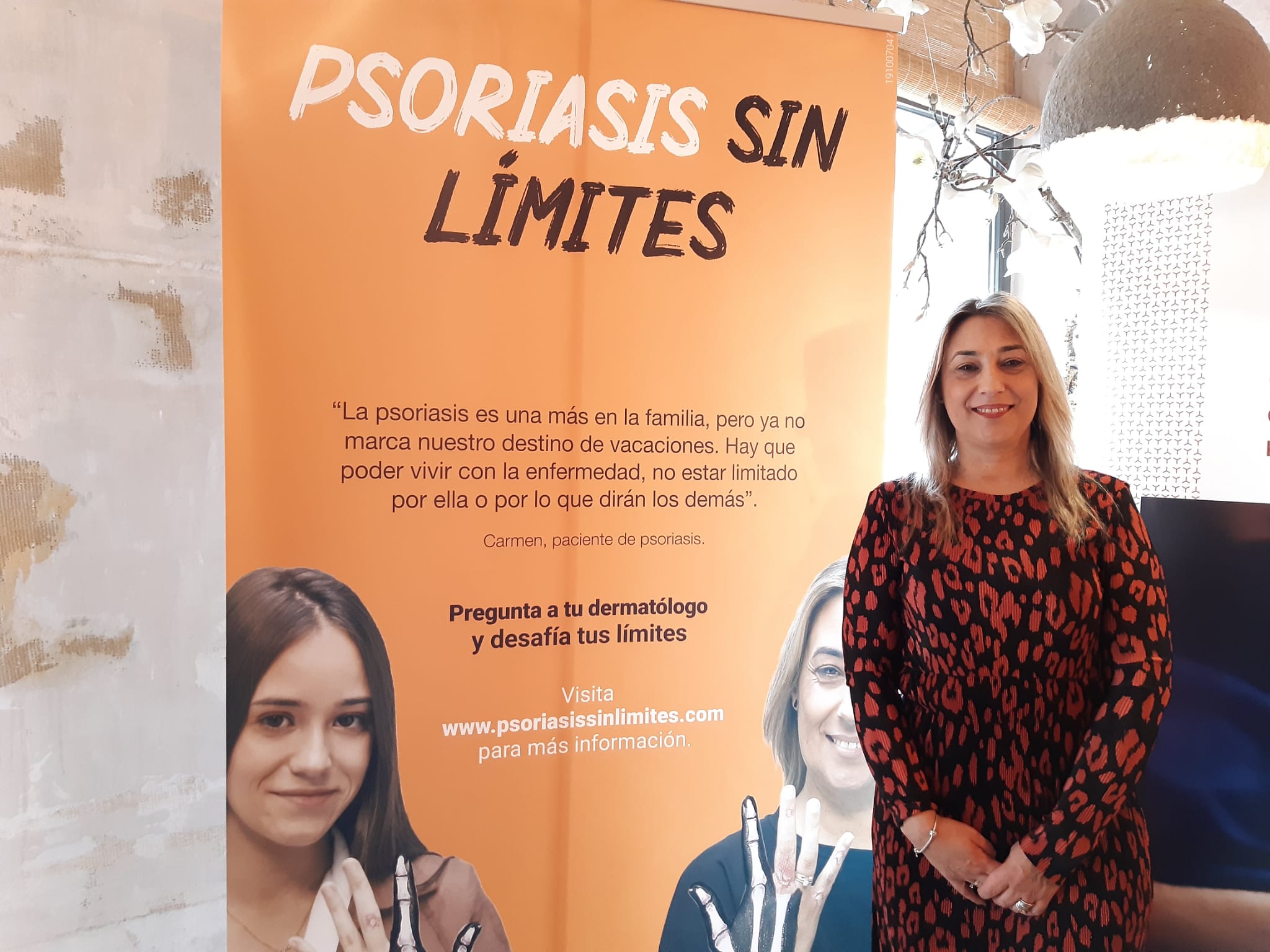 psoriasis sin limites 2 - Acción Psoriasis y Novartis lanzan la campaña "Psoriasis sin límites"