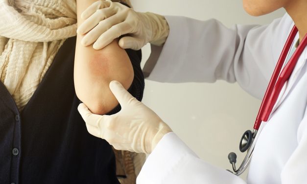 El Hospital Universitario de Toledo pone en marcha talleres multidisciplinares para pacientes con psoriasis