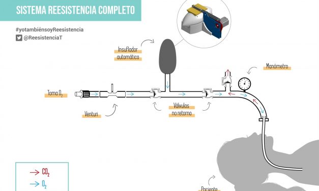 Coronavirus: Desarrollan un respirador automático con impresoras 3D ante la falta en hospitales