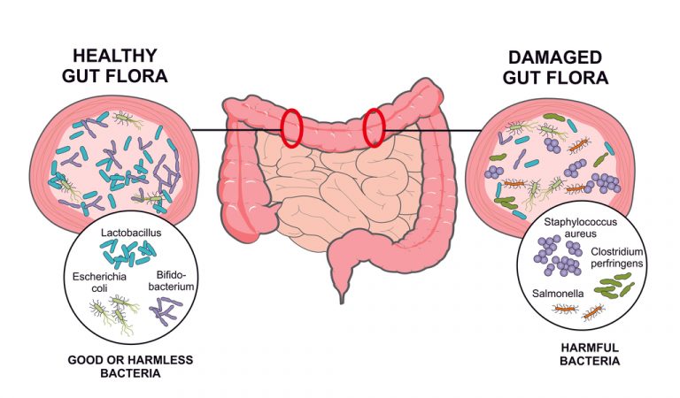 ¿Qué Es La Microbiota Intestinal? Fundamental Para Tu Salud