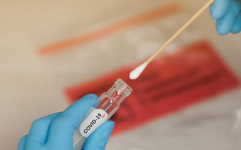 La farmacia madrileña está preparada para realizar test rápidos de la COVID-19