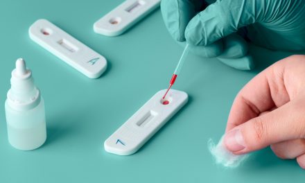 Gobierno y comunidades acuerdan pedir a los médicos que no prescriban las pruebas rápidas de anticuerpos del Covid-19