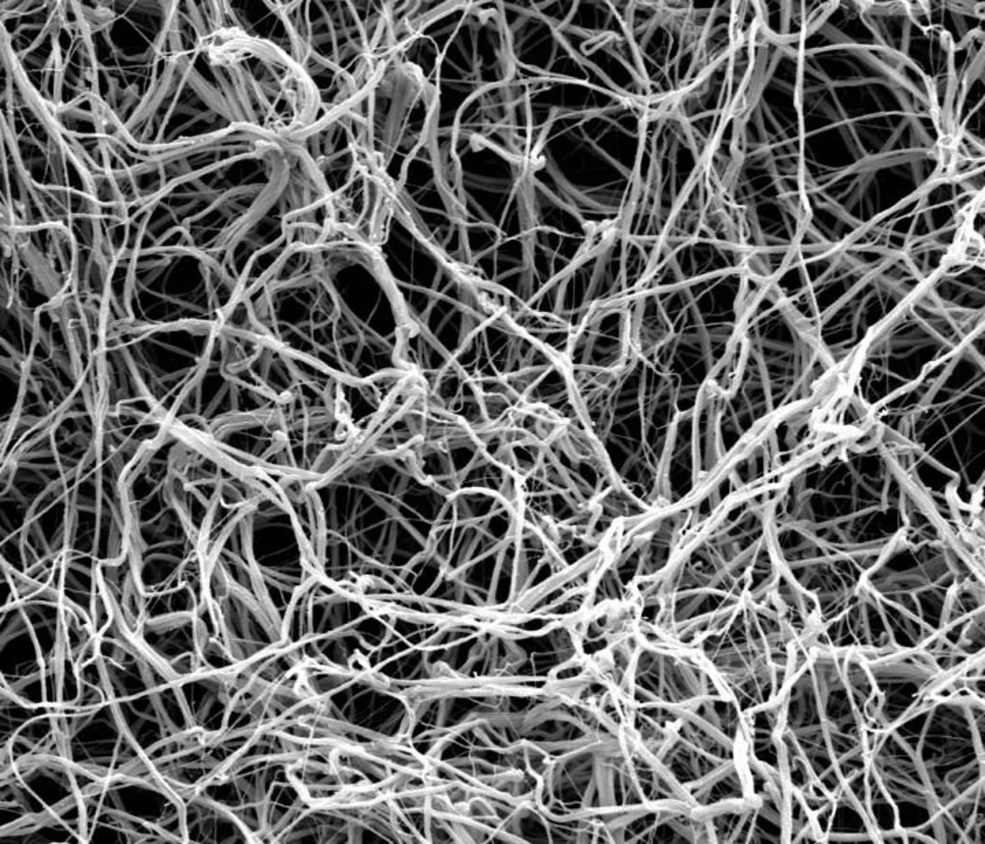 Imagen de fibras de fibrina obtenida con un microscopio electrónico.