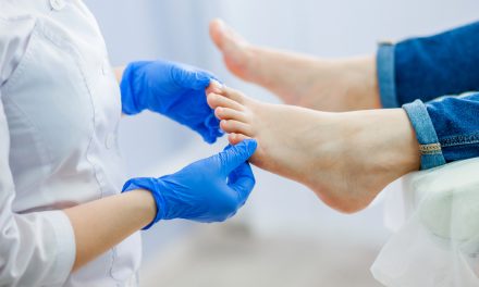 Los problemas en la salud de los pies afectan a la calidad de vida de las personas con enfermedad renal crónica