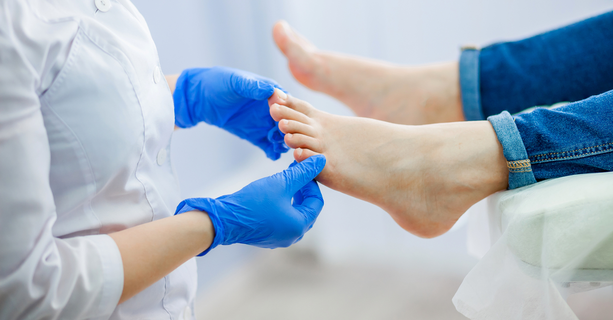 Los problemas en la salud de los pies afectan a la calidad de vida de las personas con enfermedad renal crónica