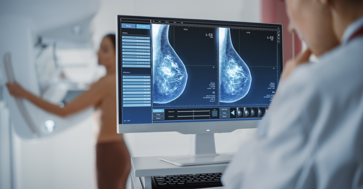 Un estudio demuestra que la irradiación parcial en cáncer de mama disminuye la toxicidad