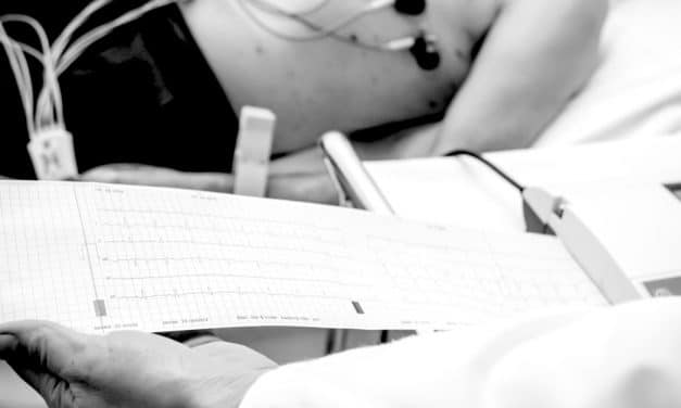 Descubren los tipos de cáncer asociados a mayor riesgo de fibrilación auricular