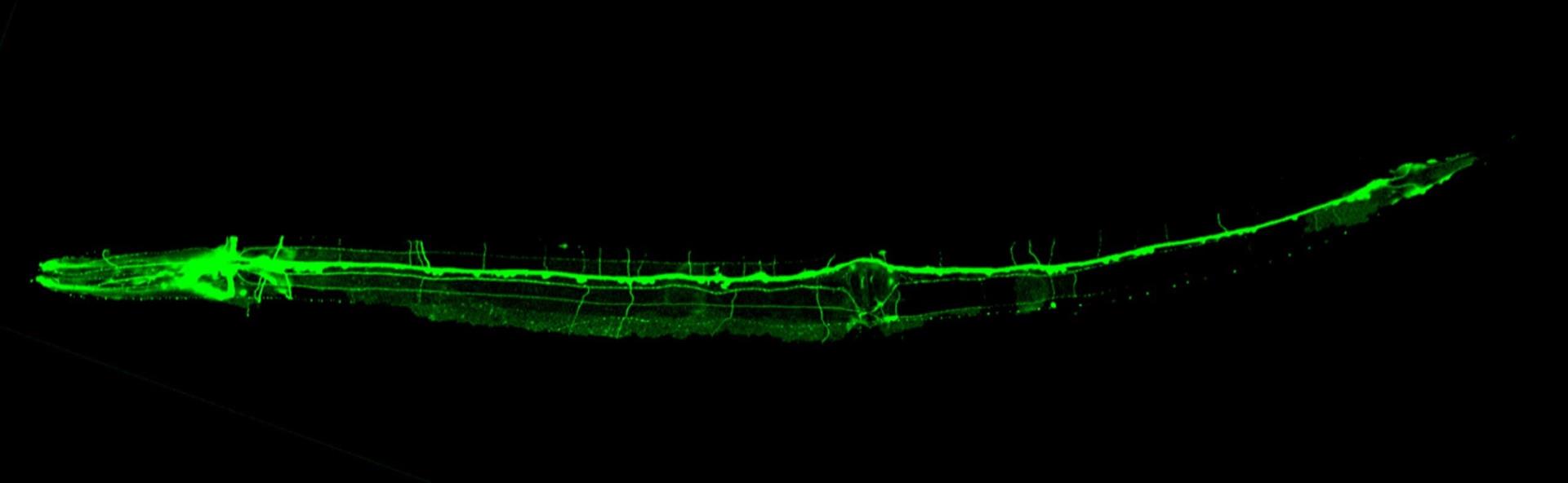 Fotografía de un animal C. Elegans transgénico que expresa la proteína de fluorescencia GFP en el sistema nervioso. - IBV-CSIC