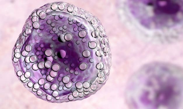 Sanidad aprueba la financiación del primer anticuerpo conjugado para el linfoma más frecuente