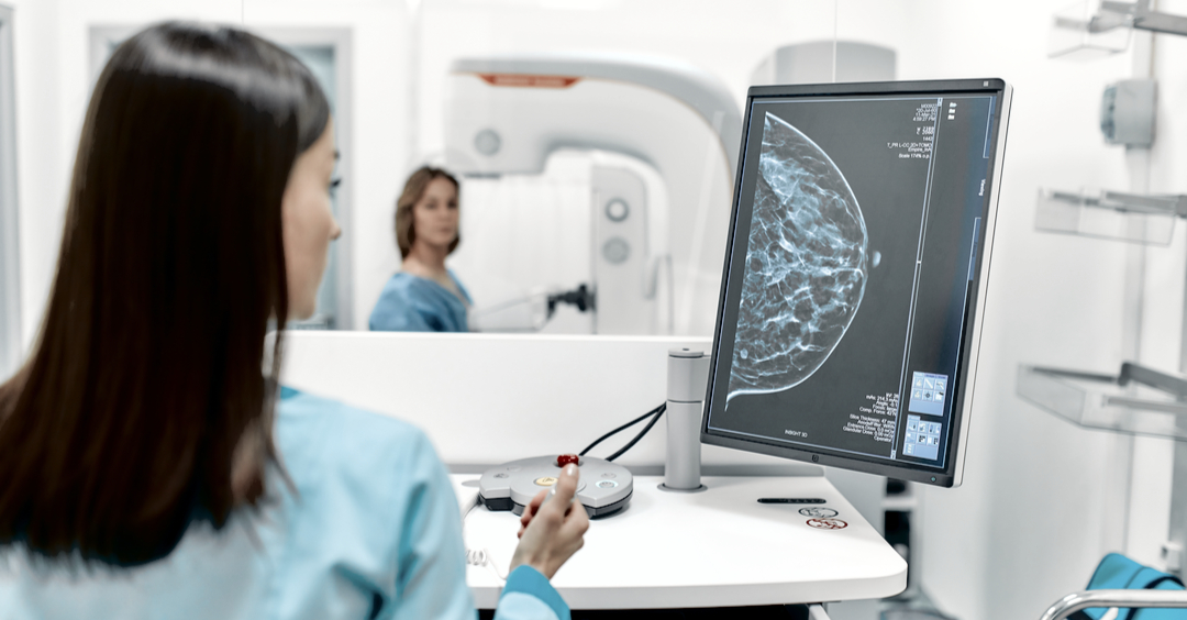 La mamografía incorpora la inteligencia artificial para evitar pruebas más invasivas