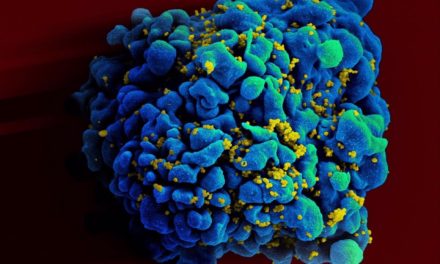 Identifican un segundo paciente con VIH no tratado cuyo cuerpo parece haberse deshecho del virus