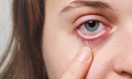 Alertan del incremento de alergias oculares en España, hasta el 40% de la población convive con alergia ocular
