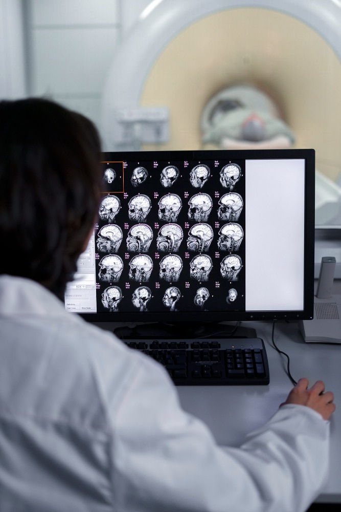 doctor mirando encima tomografia computarizada - Los errores genéticos son responsables de un porcentaje muy elevado de enfermedades raras neuropediátricas