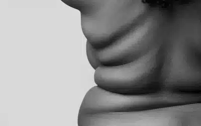 Día Mundial de la Obesidad: avances clínicos y retos compartidos para mejorar su abordaje