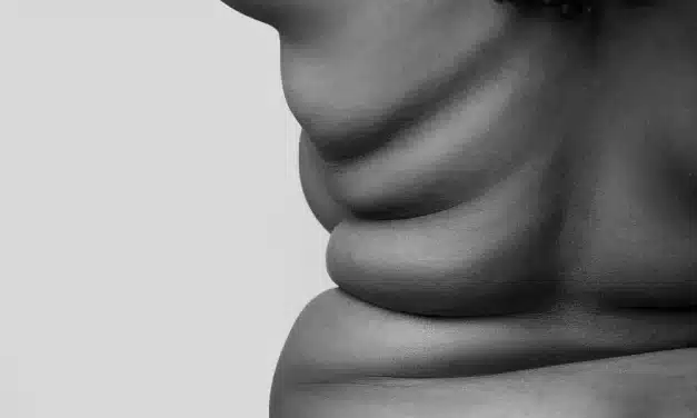 Día Mundial de la Obesidad: avances clínicos y retos compartidos para mejorar su abordaje